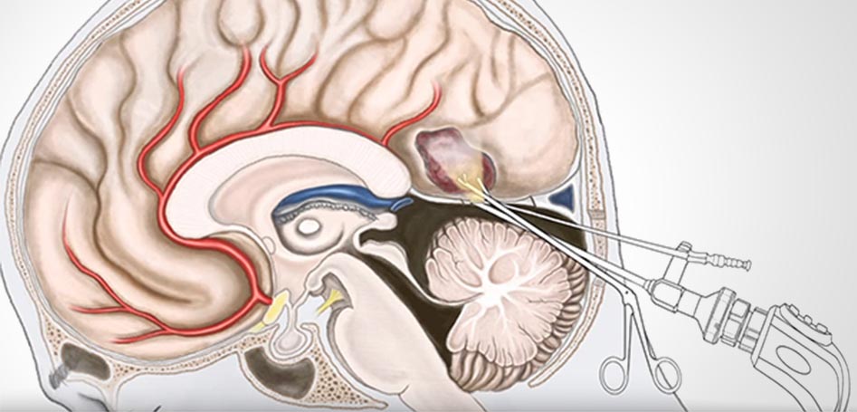 Brain & Spinal Surgery